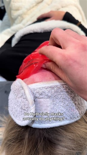 Understanding Hydrojelly Masks: Benefits and Uses
