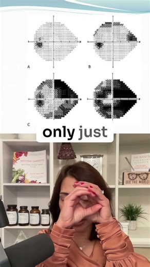 Could Early Detection Save Your Vision from Glaucoma? #GlaucomaAwareness #ProtectYourVision #Shorts