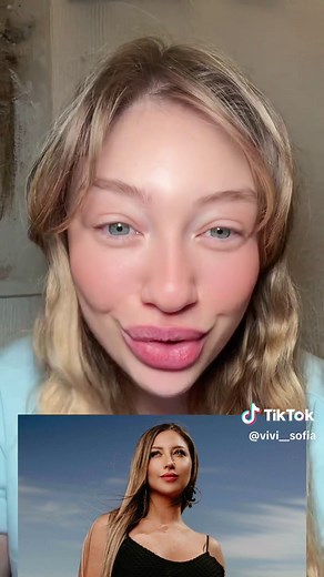 Nicole Moreno antes y después: historia de amabilidad en Chile