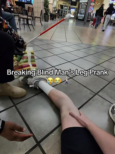 Innovative Broken Leg Prank Ideas to Try