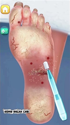 EXTREME Foot Cleaning ASMR | Oddly Satisfying & No Talking | part 6 #ASMR #FootCleaningASMR #Satisfy