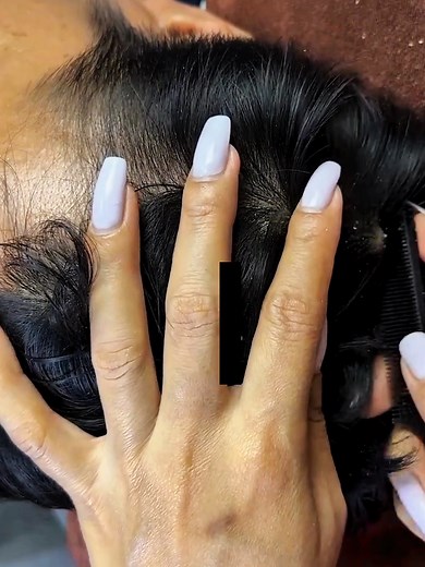 Big Flakes Dandruff Scratching Dry Scalp #DandruffScratching #ItchyDryScalp #HugeFlakes #Dandruff #dandrufftreatment #satisfying #dandruffremoval Disclaimer: Videos do not show original Dandruff, they are used for education purpose. Thank You,,,, | The Filmy