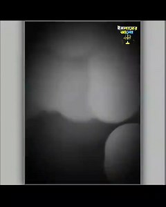 Loading Failed on Reels