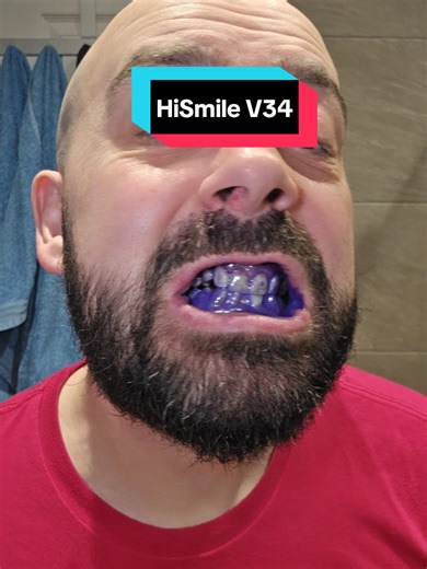Achieve Whiter Teeth with HiSmile V34