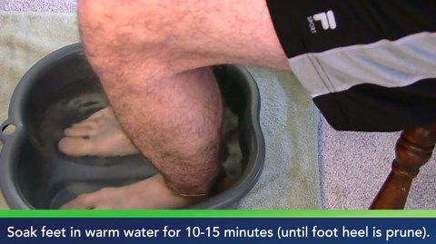 Foot Cure Lavender Foot Soak & Callus Remover Gel Kit - Remove Calluses with Epsom Salts, Callus Remover Gel for Dry Cracked Heels & Foot Odor