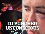 DJ-punched-unconscious-disc-jockey-nightclub.html