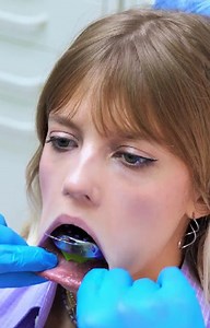 29K views · 73 reactions | The Most Common Dental Procedures Explained Simply! | 5-Minute Workouts | Facebook