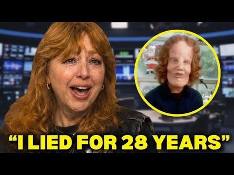 Before Her Death, Rocky Dennis' Mother Finally Revealed the Truth About Him