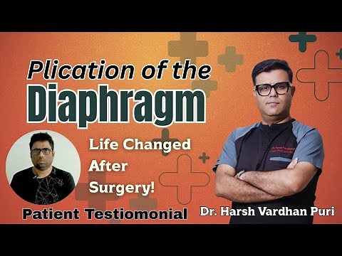 Plication of the Diaphragm Life Changed After surgery