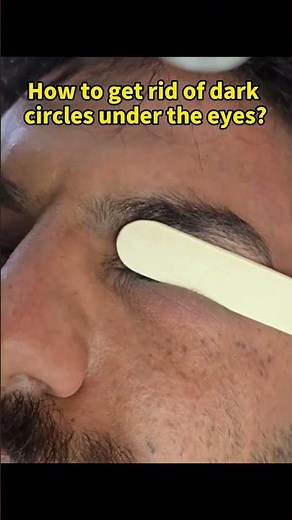 How to get rid of dark circles under the eyes?