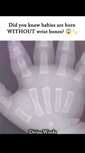 Did you know babies are born WITHOUT wrist bones? 😱🦴 #didyouknow #humanbodyfacts #bones