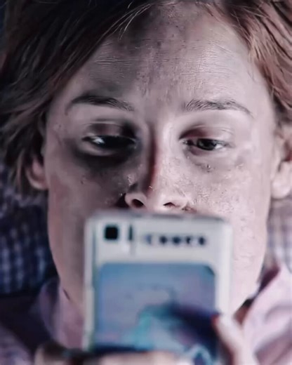 🎥 Pieles : A dark drama that explores people living with unusual physical appearances🥺
