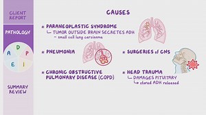 Video: Syndrome of inappropriate antidiuretic hormone (SIADH): Nursing process (ADPIE) - Video Explanation! | Osmosis | Osmosis