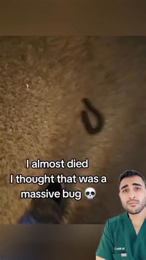 261K views · 5.4K reactions | Black mold and mycotoxin Also comment “Files” to get access to The Forbidden Files.  | Mahyar "Max" Maddahali, MD | Facebook