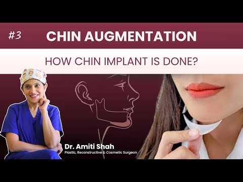 Chin Implant Surgery: Inside Mouth vs Skin Cut | How Chin Implant Is Done?