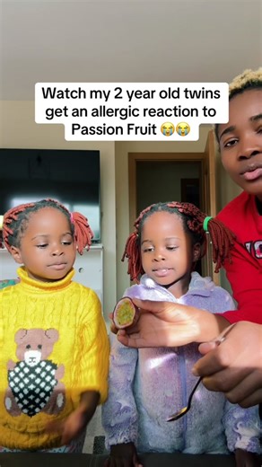 2-Year-Old Twins Experiencing Passion Fruit Allergy