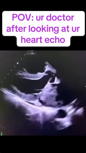 Yaz Debull, MD on Instagram: "To all my colleagues in orthopaedics, the abbreviation for cardioversion is DCCV. The AC/DC you are thinking of is just a rock band. Hope this helps."