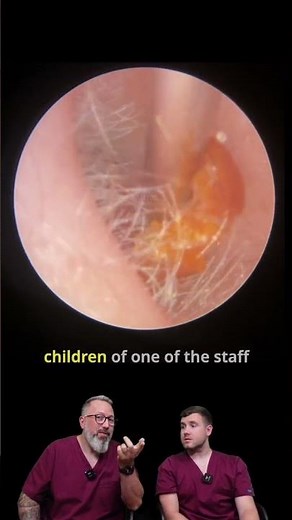 Quick Paediatric Ear Wax Removal! 😮 Satisfying Deep Clean