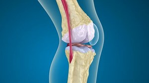 Osteoporosis Knee Joint Stock Footage Video (100% Royalty-free) 3572228 | Shutterstock