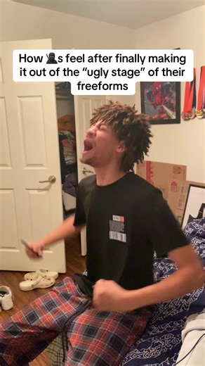 ITZZ$kovie (@freeuncleron069)’s video of ugly stage of freeforms