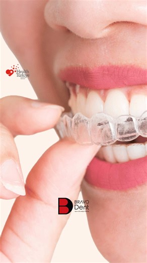 The future of smile design is now much smarter! 🤖✨ With the AI-powered software of 2026, clear aligners offer a solution that is not only aesthetic but just as effective as metal braces—and sometimes even faster! Enjoy your transformation while no one even notices you're undergoing treatment. 💎 📞 Contact and Appointment: 📱 90 544 112 07 24 📩 info@bravodent.com 🌍 bravodent.com.tr 📍 Şemsettin Günaltay Cad. Daryol Sok. Güzide Apt. No:35/A Bostancı/İstanbul (Emin Ali Paşa Metro Station Exit) 