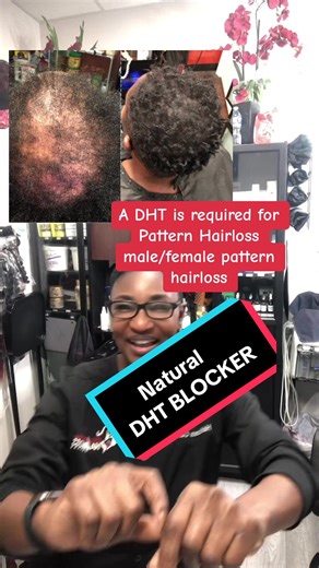 Natural DHT Blockers for Hair Loss Solutions