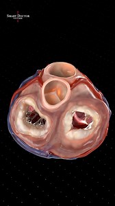 920K views · 18K reactions | See the Heart Valves 喙變 . . The human...