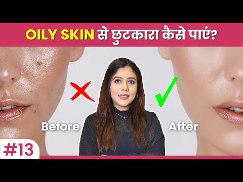how to remove oily skin on face | How To Take Care Of Oily Skin | Oily skin care routine