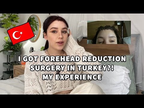 forehead reduction surgery/ hairline lowering my experience: *results* pics + vids