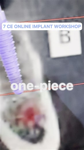 🎯 New LIVE 7 CE Online Implant Workshop with Dr. Andrea Smith! 🔥 Learn the Single Tooth Implant technique using One Piece Implants 🔥 Learn One Piece Dental Implant Anatomy, Implant Site Selection, and Placement Protocol. 🔥 Learn the Armamentarium and Different Types of One Piece Dental Implants. Join me on this unique workshop to learn how to place one piece implants for single missing teeth! https://webinars.dentalpracticemastery.com/one-piece-implant-workshop-registration | Dr. Rinesh Gana