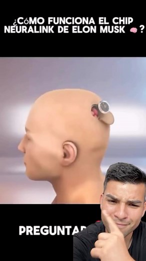 Cómo funciona el chip de Elon Musk en la cabeza será que vale la pena? #lifehacks | Lopeztips2