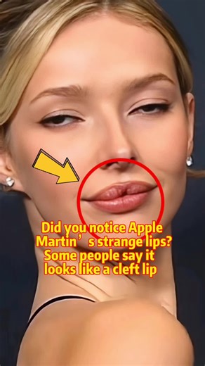 Did you notice Apple Martin’s strange lips? Some people say it looks like a cleft lip#AppleMartin #GwynethPaltrow #celebrity