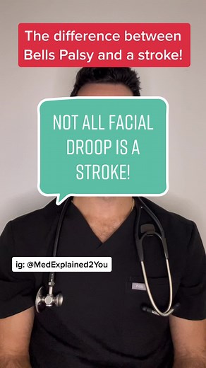 Not all facial droop is a stroke #fyp #foryou #foryoupage #stroke #medical #medicine #bellspalsy #bells #nurse #pa