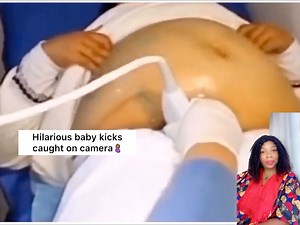 1.1M views · 10K reactions | Hilarious baby kicks caught on camera擄 Was your baby this active? | My Midwife and I #MMI | Facebook