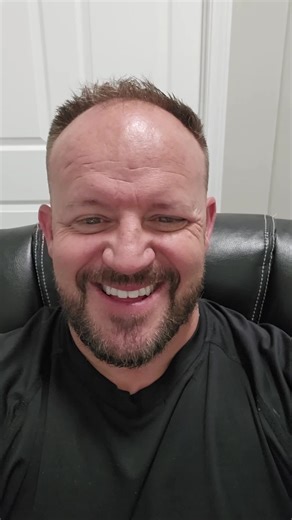 I got a pretty bad Parrot Bite today! It happens! Paradise Parrot Rescue 520-288-6310 #bite #parrot #bird #fyp #viral #story