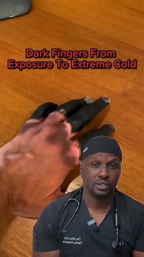 1.1K views | It is easier to prevent frostbite than it is to treat it. If you must go out in cold weather, you must take precautions. #frostbite #darkfinger #coldweathertips #coldweathersafety #thewhizdoc | Mary Johnson | Facebook