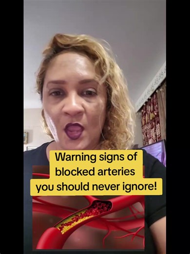 Warning Signs of Blocked Arteries You Should Never Ignore! #hearthealth #cholesterol #fyp Comment