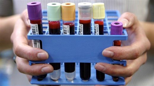 What happens in a blood cancer biobank?