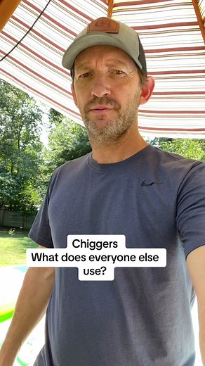 #chiggers #hotclimate #solution ##mytes##itchy##chiggerfix##chiggerprevention