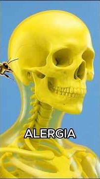 ALERGIA
