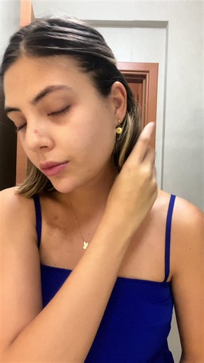 Mulheres em quimioterapia: meu tratamento de linfoma e como voltei melhor