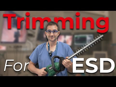 The 3 concepts for a successful ESD Trimming