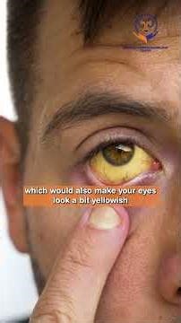 Why is my Urine Yellow? Medical Advice from Dr. Bokka Sri Harsha