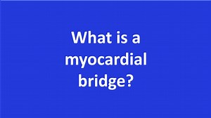 What is a myocardial bridge? - All About Heart And Blood Vessels