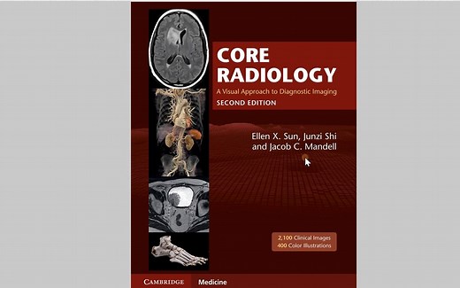 核心放射学第二版介绍（Core Radiology: A Visual Approach to Diagnostic Imaging）