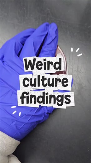 Check out this weird culture findings! Sometimes, patients may be taking antibiotics before they collect a sample for a culture. The clearing around at the top of the agar is due to antibiotics present in a urine culture. As the plate is streaked out, the antibiotic is diluted enough where bacteria to grow, but where it is present in the highest concentration, it will kill the bacteria. This can have a huge effect on the culture results including the accuracy for susceptibility testing. #microbi