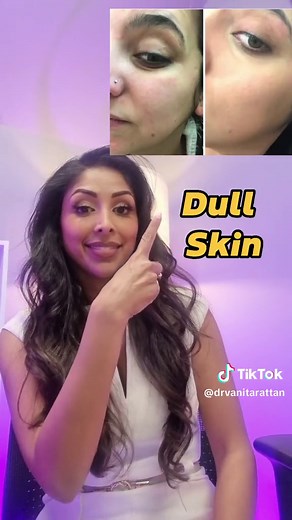 Dark under arms Use Tyrosinase Inhibitors e.g. 2% Alpha arbutin. For a stronger option Dr V Body Hyperpigmentation Kit with 10 Tyrosinase Inhibitors Dull Skin Use a chemical exfoliator e.g. mandelic from The Ordinary or the Dr V Exfoliate to glow with lactic 5%, mandelic 5%, Glycerin 7% Spots Use 5-10% Benzoyl peroxide Remove make up with a double cleanse e.g. Dr V Oil Melting Cleanser plus Micellar gel wash Cracked heels Use a stronger chemical exfoliator e.g. kerasal Angular chelitis Use Petro