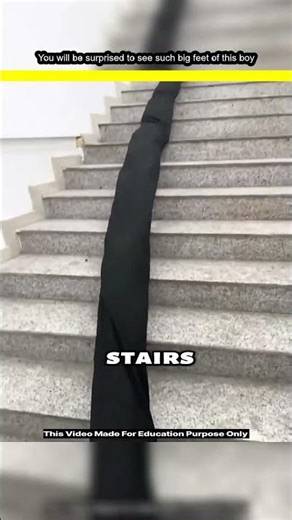 .You will be surprised to see such big feet of this boy #shortvideo