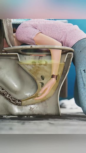 Animação 3D de Cirurgia e Conhecimento Científico (EUA)