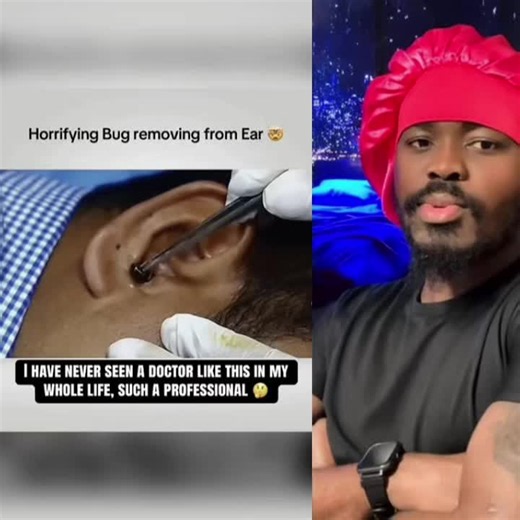 Post 2 | It just ruin my day🙈 #bug #ear #doctor #viral #nepalitiktok | earwigs bug